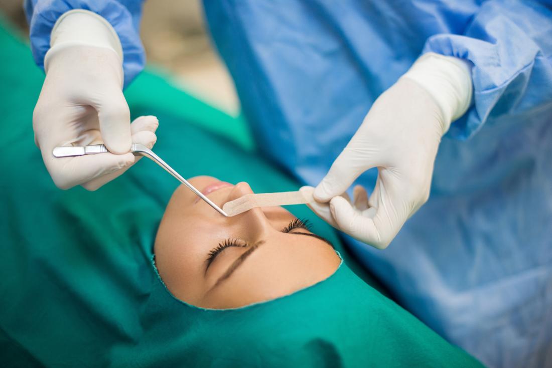 Septoplasty Procedure Description