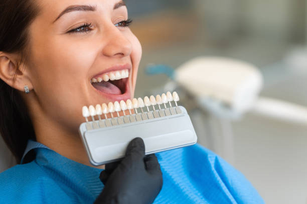 The Magic of Veneers in Transforming Smiles